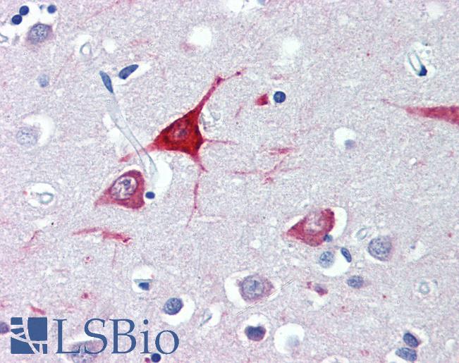 Anti-USP9X antibody IHC of human brain, cortex. Immunohistochemistry of formalin-fixed, paraffin-embedded tissue after heat-induced antigen retrieval. Antibody LS-B3846 concentration 3.75 ug/ml.