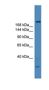 USP9Y antibody LS-C116831 Western blot of Fetal Muscle lysate.