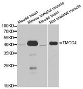 Western blot analysis of extracts of various cell lines, using TMOD4 antibody.