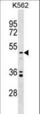 UST Antibody western blot of K562 cell line lysates (35 ug/lane). The UST antibody detected the UST protein (arrow).