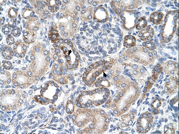 UST antibody LS-C80912 was used in IHC to stain formalin-fixed, paraffin-embedded human kidney.