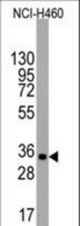 Western blot of anti-UTF1 Antibody (Center L147) (RB14073) in NCI-H460 cell line lysates (35 ug/lane). UTF1(arrow) was detected using the purified antibody.