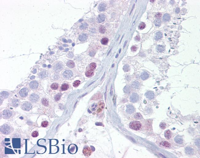 Anti-UTF1 antibody IHC of human testis. Immunohistochemistry of formalin-fixed, paraffin-embedded tissue after heat-induced antigen retrieval. Antibody LS-B6507 concentration 5 ug/ml.
