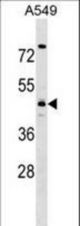 TMOD4 Antibody western blot of A549 cell line lysates (35 ug/lane). The TMOD4 antibody detected the TMOD4 protein (arrow).