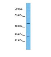 Western blot of Human HeLa. UTP11L antibody dilution 1.0 ug/ml.
