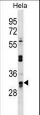 UTP11L Antibody western blot of HeLa cell line lysates (35 ug/lane). The UTP11L antibody detected the UTP11L protein (arrow).