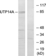 Western blot of extracts from HeLa cells, using UTP14A Antibody. The lane on the right is treated with the synthesized peptide.