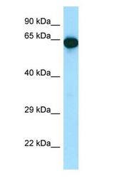 UTP15 antibody Western Blot of Mouse Pancreas.