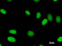 Immunostaining analysis in HeLa cells. HeLa cells were fixed with 4% paraformaldehyde and permeabilized with 0.1% Triton X-100 in PBS. The cells were immunostained with anti-UTP18 mAb.