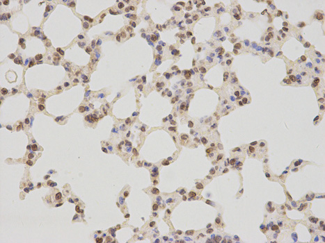 Immunohistochemistry of paraffin-embedded mouse lung using TMPO antibody at dilution of 1:200 (400x lens).