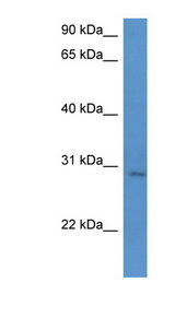 UTP23 antibody LS-C135813 Western blot of Jurkat lysate.