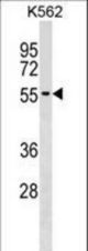 UTP3 Antibody western blot of K562 cell line lysates (35 ug/lane). The UTP3 antibody detected the UTP3 protein (arrow).