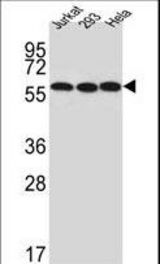 Western blot of UTP6 Antibody in Jurkat,293,HeLa cell line lysates (35 ug/lane). UTP6 (arrow) was detected using the purified antibody.