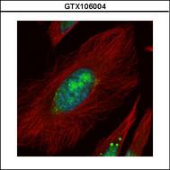 Confocal immunofluorescence analysis (Olympus FV10i) of paraformaldehyde-fixed HeLa using UTP6 antibody (green) at 1:500 dilution. Alpha-tubulin filaments were labeled with alpha-tubulin antibody (red) at 1:2500.