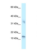UTS2D / Urotensin IIB antibody LS-C145681 Western blot of 721_B Cell lysate. Antibody concentration 1 ug/ml.