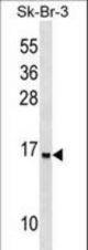 UTS2D Antibody western blot of SK-BR-3 cell line lysates (35 ug/lane). The UTS2D antibody detected the UTS2D protein (arrow).