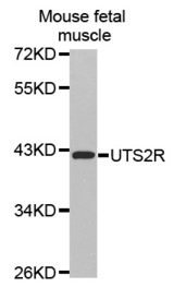 Western blot analysis of extracts of Mouse fetal muscle tissue lysate, using UTS2R antibody.