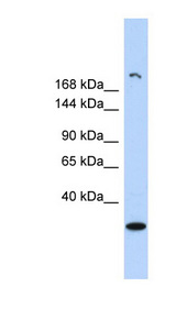 UTY antibody LS-C108064 Western blot of Fetal Brain lysate.