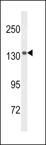 Western blot of UTY Antibody in mouse brain tissue lysates (35 ug/lane). UTY (arrow) was detected using the purified antibody.