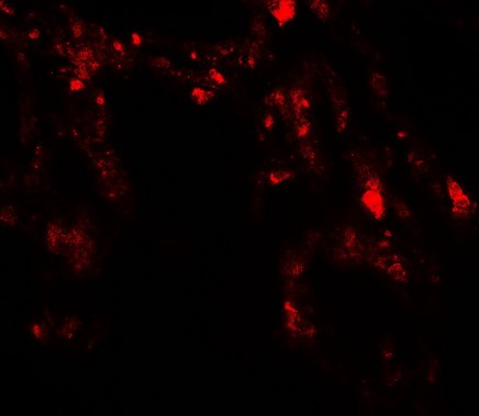 Immunofluorescence of UVRAG in human lung tissue with UVRAG antibody at 20 ug/ml.