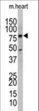 Western blot of anti-hUVRAG antibody (RB10847) in mouse heart tissue lysates. hUVRAG (arrow) was detected using the purified antibody.