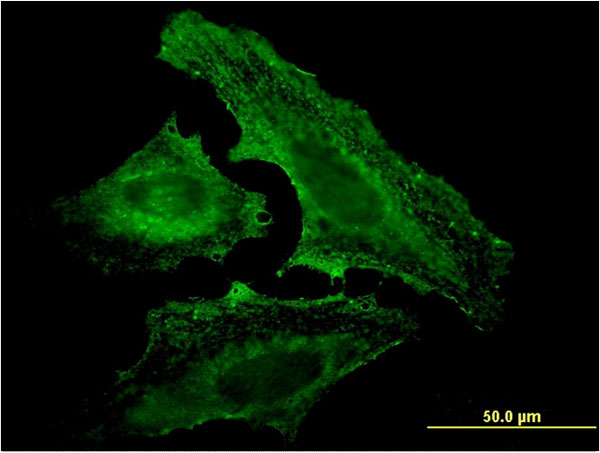 Immunofluorescence of monoclonal antibody to UVRAG on HeLa cell . [antibody concentration 10 ug/ml]