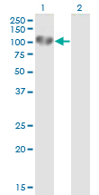 Western Blot analysis of UVRAG expression in transfected 293T cell line by UVRAG monoclonal antibody (M04), clone 2E8.Lane 1: UVRAG transfected lysate (Predicted MW: 78.2 KDa).Lane 2: Non-transfected lysate.