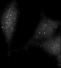 Immunofluorescence staining of Autophagy UVRAG antibody on Methanol-fixed HeLa cells. Data courtesy of Dr. Eeva-Liisa Eskelinen, University of Helsinki,Finland.