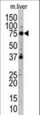 Western blot of anti-hUVRAG antibody (RB10846) in mouse liver tissue lysate. hUVRAG (arrow) was detected using the purified antibody.