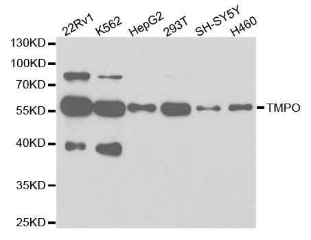 Western blot analysis of extracts of various cell lines, using TMPO antibody.