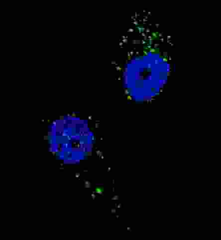 Fluorescent image of U251 cells stained with UVRAG antibody. U251 cells were treated with Chloroquine (50 mu M,16h), then fixed with 4% PFA (20 min), permeabilized with Triton X-100 (0.2%, 30 min). Cells were then incubated UVRAG primary antibody (1:200, 2 h at room temperature). For secondary antibody, Alexa Fluor 488 conjugated donkey anti-rabbit antibody (green) was used (1:1000, 1h). Nuclei were counterstained with Hoechst 33342 (blue) (10 ug/ml, 5 min). UVRAG immunoreactivity is localized to autophagic vacuoles in the cytoplasm of U251 cells.