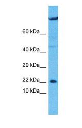 Western blot of UXT Antibody with human U937 Whole Cell lysate.