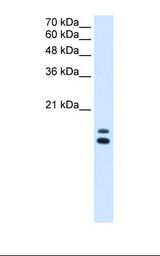 Lane A: Marker. Lane B: HepG2 cell lysate. Antibody concentration: 2.5 ug/ml. Gel concentration: 15%.