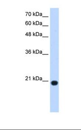 HepG2 cell lysate. Antibody concentration: 1.25 ug/ml. Gel concentration: 15%.