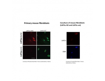 Immunocytochemistry of TMPO / Thymopoietin antibody LS-C82207.