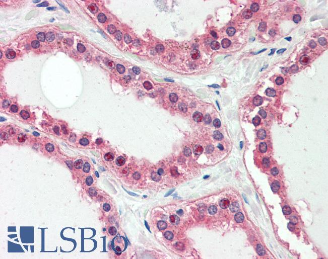 Anti-UXT antibody IHC staining of human thyroid. Immunohistochemistry of formalin-fixed, paraffin-embedded tissue after heat-induced antigen retrieval. Antibody LS-B10293 concentration 5 ug/ml.
