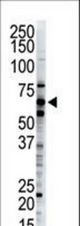 The anti-Dsk2 antibody is used in Western blot to detect Dsk2 in HeLa cell lysate.