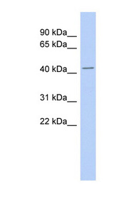 TMPO / Thymopoietin antibody LS-C110985 Western blot of Fetal Thymus lysate.