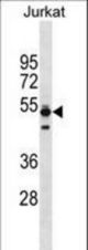 TMPO Antibody western blot of Jurkat cell line lysates (35 ug/lane). The TMPO antibody detected the TMPO protein (arrow).