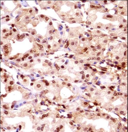 TMPO Antibody immunohistochemistry of formalin-fixed and paraffin-embedded human stomach tissue followed by peroxidase-conjugated secondary antibody and DAB staining.