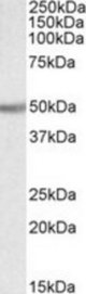 Ugt2b antibody (0.1 ug/ml) staining of Rat Kidney lysate (35 ug protein/ml in RIPA buffer). Primary incubation was 1 hour. Detected by chemiluminescence.