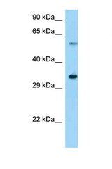 Usp27x antibody LS-C146367 Western blot of Mouse Liver lysate. Antibody concentration 1 ug/ml.