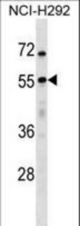 USP27X Antibody western blot of NCI-H292 cell line lysates (35 ug/lane). The USP27X antibody detected the USP27X protein (arrow).