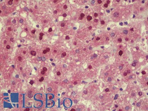 Anti-TMPO / TP / Thymopoietin antibody IHC staining of human liver. Immunohistochemistry of formalin-fixed, paraffin-embedded tissue after heat-induced antigen retrieval. Antibody LS-B9588 concentration 2.5 ug/ml.