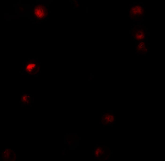 Immunofluorescence of Thymopoietin in HeLa cells with Thymopoietin antibody at 5 µg/mL.
