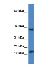 VAMP1 antibody LS-C145250 Western blot of Rat Lung lysate. Antibody concentration 1 ug/ml.