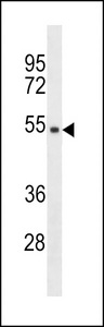 TMPPE Antibody western blot of HepG2 cell line lysates (35 ug/lane). The TMPPE antibody detected the TMPPE protein (arrow).