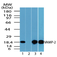Western blot of VAMP-2 in mouse embryo brain lysate in the 1) absence and 2) presence of immunizing peptide (1 ug/ml), 3) mouse brain (1 ug/ml) and 4) rat brain lysate (2 ug/ml) using LS-C148358.