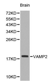 Western blot of VAMP2 pAb in extracts from mouse brain tissue.