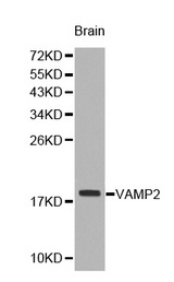 Western blot analysis of brain cell lysate using VAMP2 antibody.